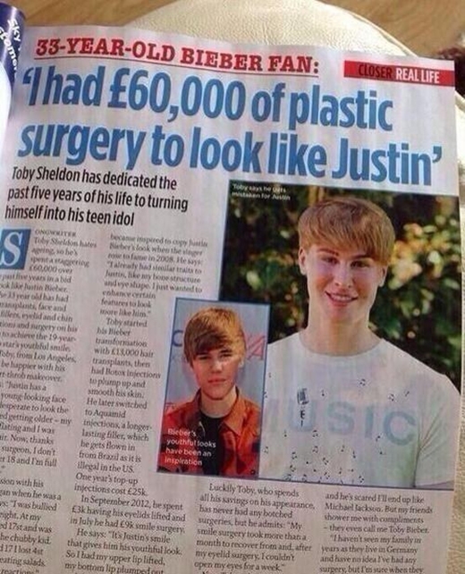
	
	Anh bạn Toby Sheldon đã chi hết 60 ngàn bảng Anh để phẫu thuật cho giống Justin.